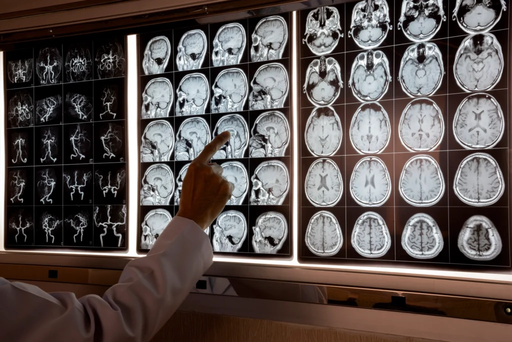Neurosurgery in Mulund